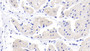 DAB staining on IHC-P; Sample: Human Cardiac Muscle Tissue; Primary Ab: 20ug/ml Mouse Anti-Human MYH7 Antibody Second Ab: 2ug/mL HRP-Linked Caprine Anti-Mouse IgG Polyclonal Antibody