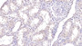 DAB staining on IHC-P; Sample: Human Kidney Tissue; Primary Ab: 30ug/ml Mouse Anti-Human PARK7 Antibody Second Ab: 2ug/mL HRP-Linked Caprine Anti-Mouse IgG Polyclonal Antibody