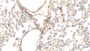 DAB staining on IHC-P; Sample: Rat Lung Tissue; Primary Ab: 10ug/ml Mouse Anti-Rat HRG Antibody; Second Ab: 2ug/mL HRP-Linked Caprine Anti-Mouse IgG Polyclonal Antibody