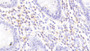 DAB staining on IHC-P; Sample: Human Colon Tissue; Primary Ab: 20ug/ml Rabbit Anti-Human IL8Rb Antibody; Second Ab: 2ug/mL HRP-Linked Caprine Anti-Rabbit IgG Polyclonal Antibody