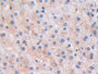 DAB staining on IHC-P; Sample: Human Liver Tissue; Primary Ab: 30ug/ml Mouse Anti-Human BNP Antibody; Second Ab: 2ug/mL HRP-Linked Caprine Anti-Mouse IgG Polyclonal Antibody