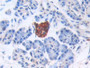 DAB staining on IHC-P; Sample: Human Pancreatic cancer Tissue; Primary Ab: 30ug/ml Mouse Anti-Human BNP Antibody; Second Ab: 2ug/mL HRP-Linked Caprine Anti-Mouse IgG Polyclonal Antibody