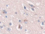 DAB staining on IHC-P; Sample: Human Cerebrum Tissue; Primary Ab: 20ug/ml Mouse Anti-Human NTXI Antibody; Second Ab: 2ug/mL HRP-Linked Caprine Anti-Mouse IgG Polyclonal Antibody