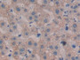 DAB staining on IHC-P; Sample: Human Liver Tissue; Primary Ab: 20ug/ml Mouse Anti-Human NTXI Antibody Second Ab: 2ug/mL HRP-Linked Caprine Anti-Mouse IgG Polyclonal Antibody