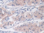 DAB staining on IHC-P; Sample: Human Stomach Tissue; Primary Ab: 20ug/ml Mouse Anti-Human NTXI Antibody; Second Ab: 2ug/mL HRP-Linked Caprine Anti-Mouse IgG Polyclonal Antibody