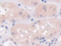 DAB staining on IHC-P; Sample: Human Kidney Tissue; Primary Ab: 20ug/ml Mouse Anti-Human NTXI Antibody; Second Ab: 2ug/mL HRP-Linked Caprine Anti-Mouse IgG Polyclonal Antibody