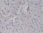 DAB staining on IHC-P; Samples: Human Liver Tissue; Primary Ab: 20ug/ml Mouse Anti-Human LRG1 Antibody Second Ab: 2ug/mL HRP-Linked Caprine Anti-Mouse IgG Polyclonal Antibody