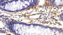 DAB staining on IHC-P; Sample: Human Colon Tissue; Primary Ab: 30ug/ml Mouse Anti-Human PIIINP Antibody Second Ab: 2ug/mL HRP-Linked Caprine Anti-Mouse IgG Polyclonal Antibody