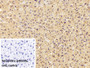 DAB staining on IHC-P; Sample: Mouse Liver Tissue; Primary Ab: 30ug/ml Mouse Anti-Rat APOB100 Antibody; Control: Used PBS instead of primary antibody; Second Ab: 2ug/ml HRP-Linked Caprine Anti-Mouse IgG Polyclonal Antibody