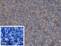 DAB staining on IHC-P; Sample: Human Pancreas Tissue; Primary Ab: 20ug/ml Rabbit Anti-Human ALDH1A1 Antibody; Control: Used PBS instead of primary antibody; Second Ab: 2ug/ml HRP-Linked Caprine Anti-Rabbit IgG Polyclonal Antibody