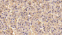 DAB staining on IHC-P; Sample: Porcine Pituitary Tissue; Primary Ab: 20ug/ml Mouse Anti-Mouse FSHb Antibody Second Ab: 2ug/mL HRP-Linked Caprine Anti-Mouse IgG Polyclonal Antibody