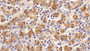 DAB staining on IHC-P; Sample: Porcine Pituitary Tissue; Primary Ab: 20ug/ml Mouse Anti-Rat FSHb Antibody Second Ab: 2ug/mL HRP-Linked Caprine Anti-Mouse IgG Polyclonal Antibody