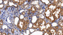DAB staining on IHC-P; Sample: Human Kidney Tissue; Primary Ab: 10ug/ml Rabbit Anti-Human CAT Antibody; Second Ab: 2ug/mL HRP-Linked Caprine Anti-Rabbit IgG Polyclonal Antibody