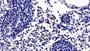 DAB staining on IHC-P; Sample: Rat Lymph node Tissue; Primary Ab: 10ug/ml Rabbit Anti-Rat CASP4 Antibody; Second Ab: 2ug/mL HRP-Linked Caprine Anti-Rabbit IgG Polyclonal Antibody