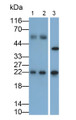 Western Blot; Samples: Lane1: Mouse Cerebellum lysate; Lane2: Mouse Pituitary lysate; Lane3: SH-SY5Y cell lysate; Primary Ab: 0.05ug/ml Mouse Anti-Human FSHb Antibody; Second Ab: 0.2ug/ml HRP-Linked Caprine Anti-Mouse IgG Polyclonal Antibody