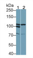 Western Blot; Sample: Lane1: K562 cell lysate; Lane2: 3T3-L1 cell lysate Primary Ab: 0.4ug/ml Mouse Anti-Mouse CSF2Rb Antibody Second Ab: 0.2ug/mL HRP-Linked Caprine Anti-Mouse IgG Polyclonal Antibody