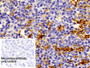 DAB staining on IHC-P; Sample: Human Spleen Tissue; Primary Ab: 10ug/ml Rabbit Anti-Human HO1 Antibody; Control: Used PBS instead of primary antibody; Second Ab: 2ug/ml HRP-Linked Caprine Anti-Rabbit IgG Polyclonal Antibody