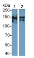 Western Blot; Sample: Lane1: Rat Spleen lysate; Lane2: Mouse Spleen lysate Primary Ab: 0.2ug/ml Rabbit Anti-Human THBS1 Antibody Second Ab: 0.2ug/mL HRP-Linked Caprine Anti-Rabbit IgG Polyclonal Antibody