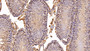 DAB staining on IHC-P; Sample: Rat Testis Tissue; Primary Ab: 20ug/ml Rabbit Anti-Rat SIRT1 Antibody Second Ab: 2ug/mL HRP-Linked Caprine Anti-Rabbit IgG Polyclonal Antibody