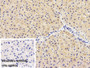 DAB staining on IHC-P; Sample: Porcine Liver Tissue; Primary Ab: 10ug/ml Rabbit Anti-Caprine Hpt Antibody; Control: Used PBS instead of primary antibody; Second Ab: 2ug/ml HRP-Linked Caprine Anti-Rabbit IgG Polyclonal Antibody