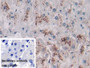 DAB staining on IHC-P; Sample: Human Liver Tissue; Primary Ab: 30ug/ml Mouse Anti-Human PLA2G4 Antibody; Control: Used PBS instead of primary antibody; Second Ab: 2ug/ml HRP-Linked Caprine Anti-Mouse IgG Polyclonal Antibody