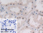 DAB staining on IHC-P; Sample: Human Kidney Tissue; Primary Ab: 30ug/ml Mouse Anti-Human PLA2G4 Antibody; Control: Used PBS instead of primary antibody; Second Ab: 2ug/ml HRP-Linked Caprine Anti-Mouse IgG Polyclonal Antibody