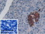 DAB staining on IHC-P; Sample: Human Pancreas Tissue; Primary Ab: 30ug/ml Mouse Anti-Human PLA2G4 Antibody; Control: Used PBS instead of primary antibody; Second Ab: 2ug/ml HRP-Linked Caprine Anti-Mouse IgG Polyclonal Antibody