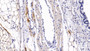 DAB staining on IHC-P; Sample: Rat Lung Tissue; Primary Ab: 30ug/ml Mouse Anti-Human BST1 Antibody; Second Ab: 2ug/mL HRP-Linked Caprine Anti-Mouse IgG Polyclonal Antibody