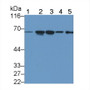 Western Blot; Sample: Lane1: Rat Prostate lysate; Lane2: 293T cell lysate; Lane3: PC3 cell lysate; Lane4: DU145 cell lysate; Lane5: MCF7 cell lysate Primary Ab: 1ug/ml Mouse Anti-Human TMPRSS2 Antibody Second Ab: 0.2ug/mL HRP-Linked Caprine Anti-Mouse IgG Polyclonal Antibody