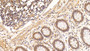DAB staining on IHC-P; Sample: Human Rectum Tissue; Primary Ab: 20ug/ml Mouse Anti-Human VEGFC Antibody; Second Ab: 2ug/mL HRP-Linked Caprine Anti-Mouse IgG Polyclonal Antibody