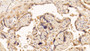 DAB staining on IHC-P; Sample: Human Placenta Tissue; Primary Ab: 20ug/ml Mouse Anti-Human VEGFC Antibody; Second Ab: 2ug/mL HRP-Linked Caprine Anti-Mouse IgG Polyclonal Antibody