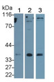 Western Blot; Sample: Lane1: Rat Spinal cord lysate; Lane2: Rat Cerebellum lysate; Lane3: PC3 cell lysate Primary Ab: 0.2ug/ml Mouse Anti-Human b3GAT1 Antibody Second Ab: 0.2ug/mL HRP-Linked Caprine Anti-Mouse IgG Polyclonal Antibody