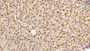 DAB staining on IHC-P; Sample: Rat Liver Tissue; Primary Ab: 20ug/ml Rabbit Anti-Human GSTp Antibody; Second Ab: 2ug/mL HRP-Linked Caprine Anti-Rabbit IgG Polyclonal Antibody