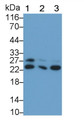 Western Blot; Sample: Lane1: Rat Cerebrum lysate; Lane2: Mouse Cerebrum lysate; Lane3: Porcine Cerebrum lysate Primary Ab: 1.5ug/ml Mouse Anti-Hamster GSTp Antibody Second Ab: 0.2ug/mL HRP-Linked Caprine Anti-Mouse IgG Polyclonal Antibody