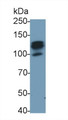 Western Blot; Sample: K562 cell lysate Primary Ab: 0.5ug/ml Mouse Anti-Mouse CSF2Rb Antibody Second Ab: 0.2ug/mL HRP-Linked Caprine Anti-Mouse IgG Polyclonal Antibody