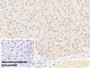 DAB staining on IHC-P; Sample: Human Liver Tissue; Primary Ab: 20ug/ml Mouse Anti-Human Plg Antibody; Control: Used PBS instead of primary antibody; Second Ab: 2ug/ml HRP-Linked Caprine Anti-Mouse IgG Polyclonal Antibody