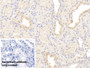 DAB staining on IHC-P; Sample: Human Kidney Tissue; Primary Ab: 20ug/ml Mouse Anti-Human Plg Antibody; Control: Used PBS instead of primary antibody; Second Ab: 2ug/ml HRP-Linked Caprine Anti-Mouse IgG Polyclonal Antibody