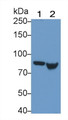 Western Blot; Sample: Lane1: Rat Lung lysate; Lane2: Rat Placenta lysate Primary Ab: 0.5ug/ml Mouse Anti-Mouse TGM2 Antibody Second Ab: 0.2ug/mL HRP-Linked Caprine Anti-Mouse IgG Polyclonal Antibody