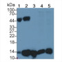 Western Blot; Sample: Lane1: Human Serum; Lane2: Human Urine; Lane3: Human Leukocyte lysate; Lane4: A431 cell lysate; Lane5: Raji cell lysate; Primary Ab: 2ug/ml Mouse Anti-Human b2M Antibody; Second Ab: 0.2ug/mL HRP-Linked Caprine Anti-Mouse IgG Polyclonal Antibody