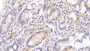 DAB staining on IHC-P; Sample: Human Small intestine Tissue; Primary Ab: 20ug/ml Mouse Anti-Human MMP7 Antibody Second Ab: 2ug/mL HRP-Linked Caprine Anti-Mouse IgG Polyclonal Antibody