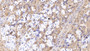 DAB staining on IHC-P; Samples: Human Stomach Tissue; Primary Ab: 10ug/ml Mouse Anti-Human b2M Antibody Second Ab: 2ug/mL HRP-Linked Caprine Anti-Mouse IgG Polyclonal Antibody