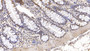 DAB staining on IHC-P; Samples: Human Colon Tissue; Primary Ab: 10ug/ml Mouse Anti-Human IGFBP4 Antibody Second Ab: 2ug/mL HRP-Linked Caprine Anti-Mouse IgG Polyclonal Antibody