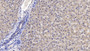 DAB staining on IHC-P; Samples: Human Liver Tissue; Primary Ab: 10ug/ml Mouse Anti-Human IGFBP4 Antibody Second Ab: 2ug/mL HRP-Linked Caprine Anti-Mouse IgG Polyclonal Antibody