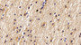 DAB staining on IHC-P; Sample: Human Cerebrum Tissue; Primary Ab: 20ug/ml Mouse Anti-Human WSFS1 Antibody Second Ab: 2ug/mL HRP-Linked Caprine Anti-Mouse IgG Polyclonal Antibody