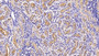 DAB staining on IHC-P; Sample: Human Kidney Tissue; Primary Ab: 30ug/ml Mouse Anti-Human NEP Antibody Second Ab: 2ug/mL HRP-Linked Caprine Anti-Mouse IgG Polyclonal Antibody