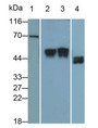 Western Blot; Sample: Lane1: Rat Cerebrum lysate; Lane2: Rat Placenta lysate; Lane3: A431 cell lysate; Lane4: SKOV3 cell lysate Primary Ab: 1ug/ml Mouse Anti-Rat uPAR Antibody Second Ab: 0.2ug/mL HRP-Linked Caprine Anti-Mouse IgG Polyclonal Antibody