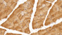 DAB staining on IHC-P; Sample: Rat Skeletal muscle Tissue; Primary Ab: 20ug/ml Mouse Anti-Human CKM Antibody Second Ab: 2ug/mL HRP-Linked Caprine Anti-Mouse IgG Polyclonal Antibody