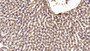 DAB staining on IHC-P; Sample: Rat Liver Tissue; Primary Ab: 20ug/ml Mouse Anti-Multi-species STAT3 Antibody; Second Ab: 2ug/mL HRP-Linked Caprine Anti-Mouse IgG Polyclonal Antibody