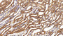 DAB staining on IHC-P; Sample: Rat Kidney Tissue; Primary Ab: 20ug/ml Mouse Anti-Multi-species STAT3 Antibody; Second Ab: 2ug/mL HRP-Linked Caprine Anti-Mouse IgG Polyclonal Antibody