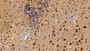 DAB staining on IHC-P; Sample: Rat Cerebrum Tissue; Primary Ab: 20ug/ml Mouse Anti-Multi-species STAT3 Antibody; Second Ab: 2ug/mL HRP-Linked Caprine Anti-Mouse IgG Polyclonal Antibody